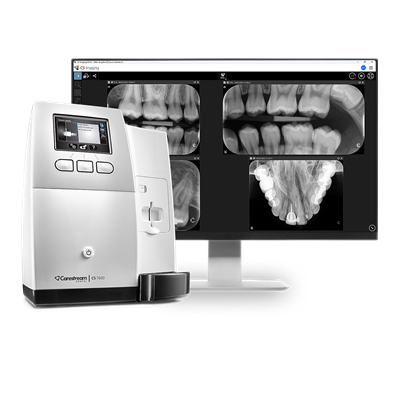 Carestream CS 7600, dahinter Monitor mit Röntgenaufnahme