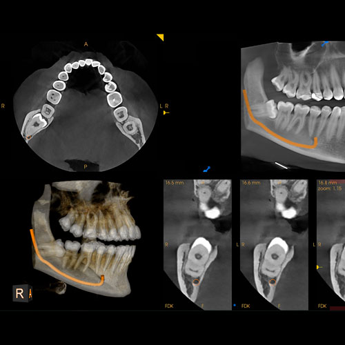 Bild von Röntgen-Scans des Carestream CS 8200 3D