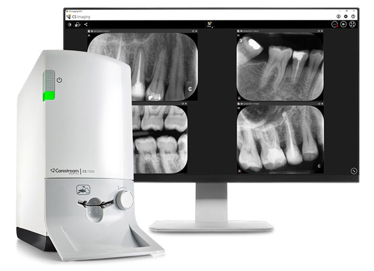 Carestream CS 7200 mit Screenshot der Software auf Monitor